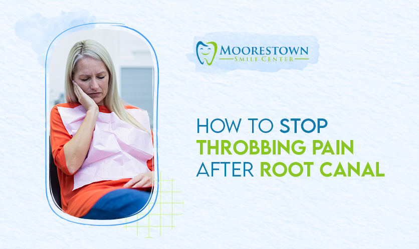 How to Stop Throbbing Pain after Root Canal