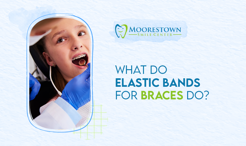 what do elastic bands for braces do