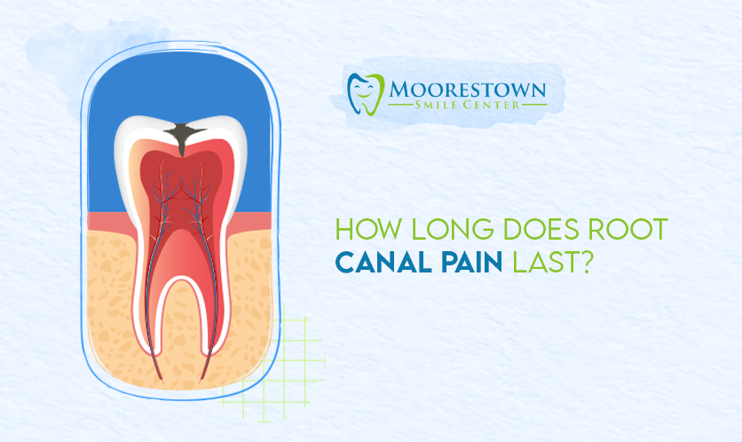 How Long Does Root Canal Pain Last