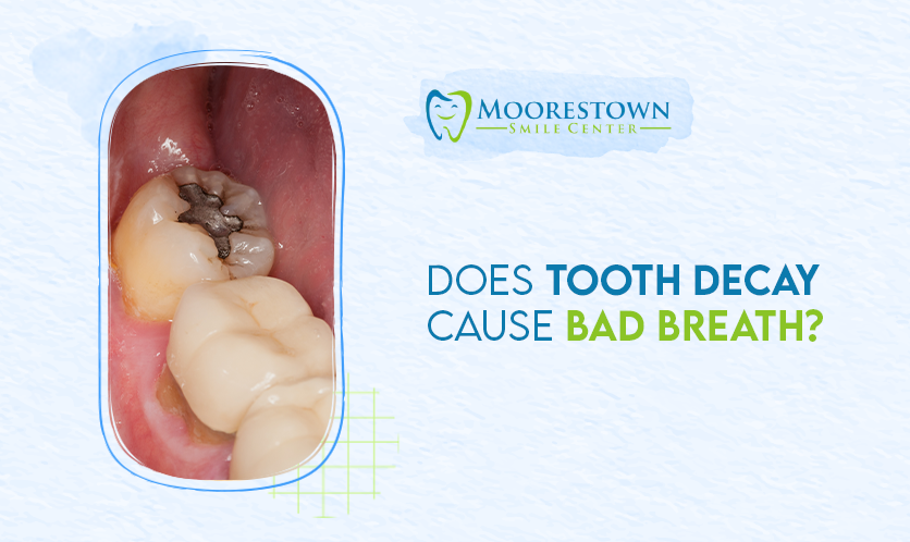 Does Tooth Decay Cause Bad Breath