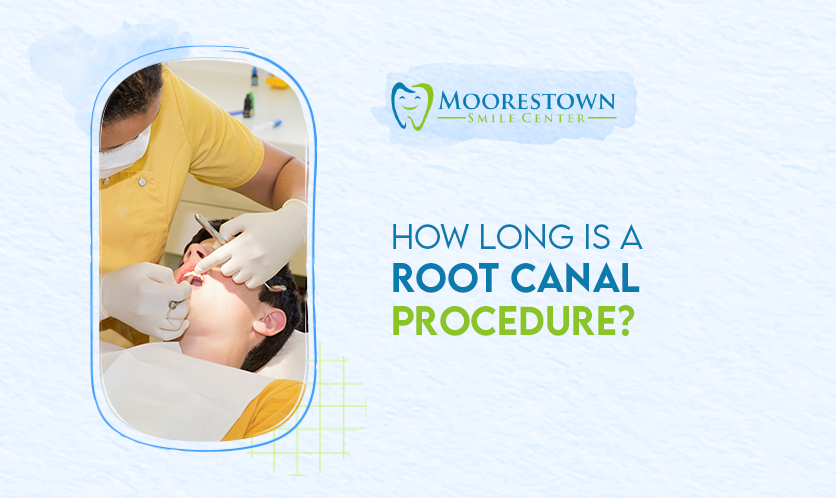 How Long Is a Root Canal Procedure?