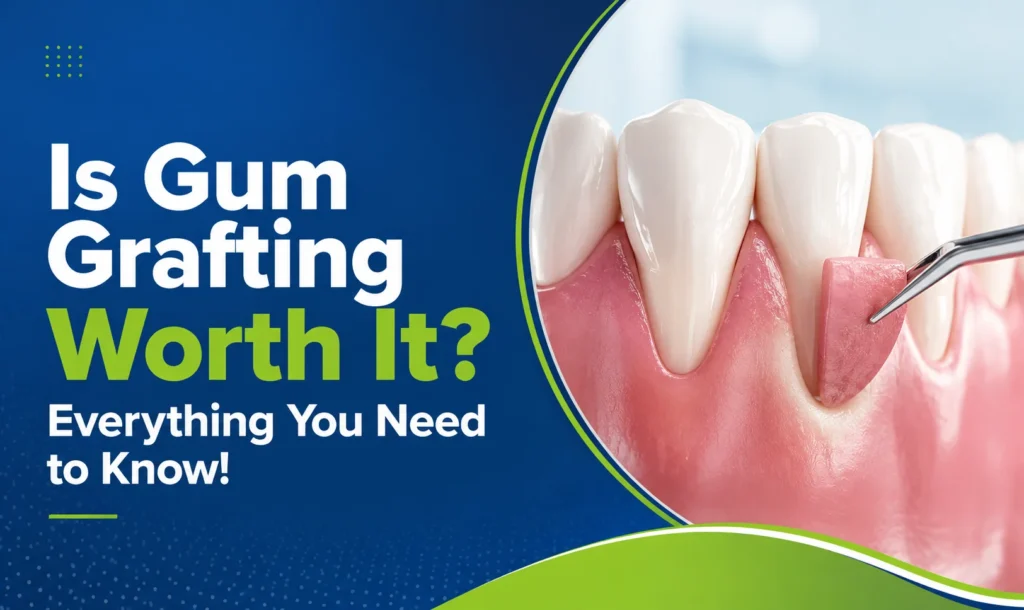 Is Gum Grafting Worth It