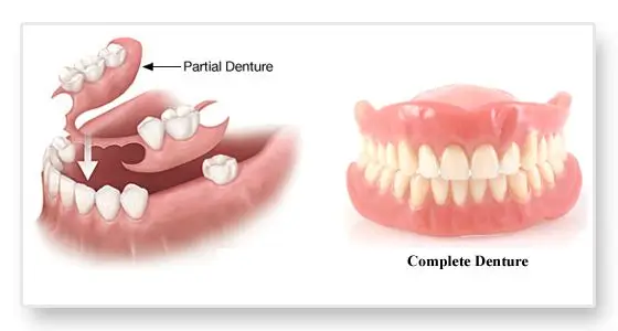 Partial & Full Denture Moorestown NJ