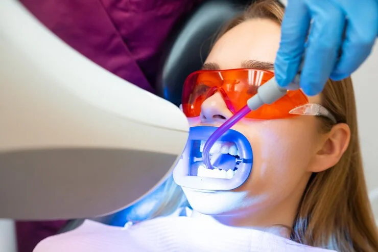 Teeth Whitening