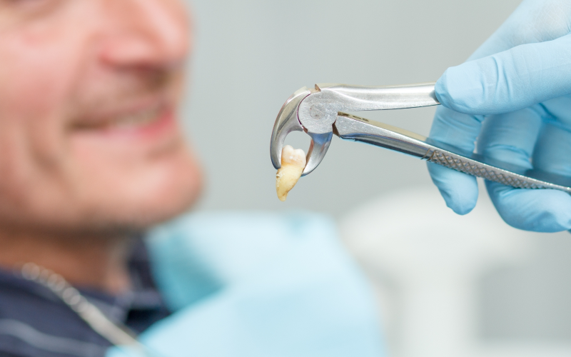 Tooth Extraction Moorestown NJ