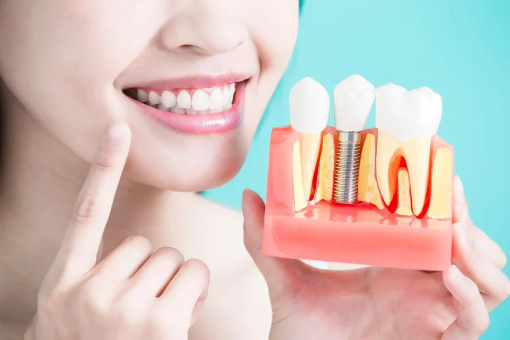 Dental Implants Moorestown NJ